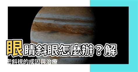 斜眼|斜視：成因、病徵及治療 